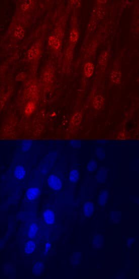 DLX5 was detected in immersion fixed human mesenchymal stem cells differentiated into osteocytes using Sheep Anti-Human DLX5 Antigen Affinity-purified Polyclonal Antibody (Catalog # AF6710) at 10 µg/mL for 3 hours at room temperature. Cells were stained using the NorthernLights™ 557-conjugated Anti-Sheep IgG Secondary Antibody (red, upper panel; Catalog # NL010) and counterstained with DAPI (blue, lower panel). Specific staining was localized to nuclei and cytoplasm. View our protocol for Fluorescent ICC Staining of Cells on Coverslips.