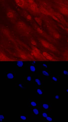 DLX5 was detected in immersion fixed human mesenchymal stem cells differentiated into osteocytes using Mouse Anti-Human DLX5 Monoclonal Antibody (Catalog # MAB6710) at 10 µg/mL for 3 hours at room temperature. Cells were stained using the NorthernLights™ 557-conjugated Anti-Mouse IgG Secondary Antibody (red, upper panel; Catalog # NL007) and counterstained with DAPI (blue, lower panel). Specific staining was localized to nuclei and cytoplasm. View our protocol for Fluorescent ICC Staining of Cells on Coverslips.
