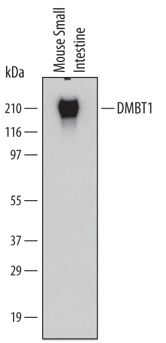 Western Blot DMBT1/GP340 Antibody (548012)