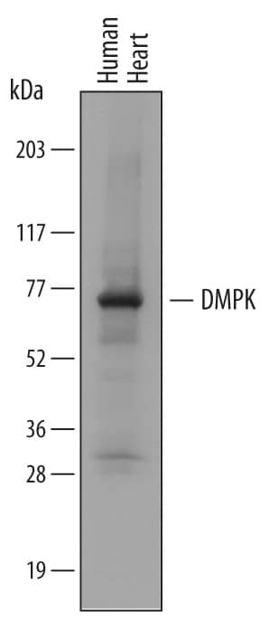 Western Blot DMPK Antibody (713931)