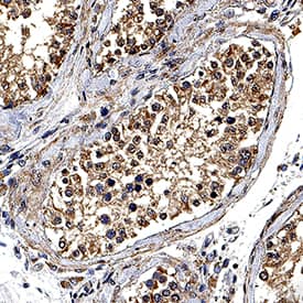 Immunohistochemistry DNAH17 Antibody (981717) [Unconjugated]