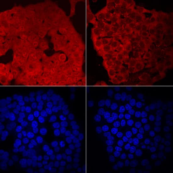 DNMT1 was detected in immersion fixed HCT-116 human colorectal carcinoma cell line untreated (left panels) and treated (right panels) with 1 µM 5-azacytidine for 24 hours using Sheep Anti-Human DNMT1 Antigen Affinity-purified Polyclonal Antibody (Catalog # AF6110) at 10 µg/mL for 3 hours at room temperature. Cells were stained using the NorthernLights™ 557-conjugated Anti-Sheep IgG Secondary Antibody (red, upper panels; Catalog # NL010) and counterstained with DAPI (blue, lower panels). Specific staining was localized to nuclei and cytoplasm. Nuclear staining was reduced following treatment with 5-azacytidine. View our protocol for Fluorescent ICC Staining of Cells on Coverslips.