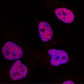 DNMT1 was detected in immersion fixed HeLa human cervical epithelial carcinoma cell line using Sheep Anti-Human DNMT1 Antigen Affinity-purified Polyclonal Antibody (Catalog # AF6110) at 1.7 µg/mL for 3 hours at room temperature. Cells were stained using the NorthernLights™ 557-conjugated Anti-Sheep IgG Secondary Antibody (red; Catalog # NL010) and counterstained with DAPI (blue). Specific staining was localized to nuclei. View our protocol for Fluorescent ICC Staining of Cells on Coverslips.