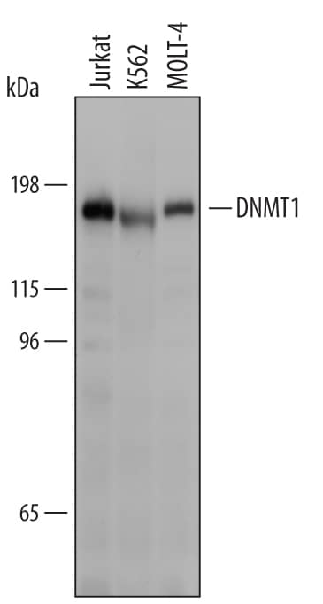 Western blot shows lysates of Jurkat human acute T cell leukemia cell line, K562 human chronic myelogenous leukemia cell line, and MOLT-4 human acute lymphoblastic leukemia cell line. PVDF Membrane was probed with 1 µg/mL of Sheep Anti-Human DNMT1 Antigen Affinity-purified Polyclonal Antibody (Catalog # AF6110) followed by HRP-conjugated Anti-Sheep IgG Secondary Antibody (Catalog # HAF016). A specific band was detected for DNMT1 at approximately 183 kDa (as indicated). This experiment was conducted under reducing conditions and using Immunoblot Buffer Group 1.