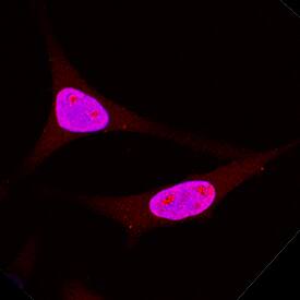 DNMT3A was detected in immersion fixed HeLa human cervical epithelial carcinoma cell line using Goat Anti-Human DNMT3A Antigen Affinity-purified Polyclonal Antibody (Catalog # AF6315) at 1.7 µg/mL for 3 hours at room temperature. Cells were stained using the NorthernLights™ 557-conjugated Anti-Mouse IgG Secondary Antibody (red; Catalog # NL007) and counterstained with DAPI (blue). Specific staining was localized to nuclei. View our protocol for Fluorescent ICC Staining of Cells on Coverslips.