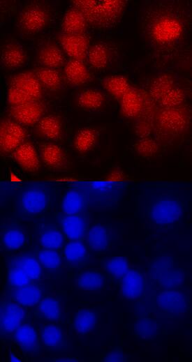 DNMT3A was detected in immersion fixed OVCAR-3 human ovarian carcinoma cell line using Mouse Anti-Human DNMT3A Monoclonal Antibody (Catalog # MAB6315) at 10 µg/mL for 3 hours at room temperature. Cells were stained using the NorthernLights™ 557-conjugated Anti-Mouse IgG Secondary Antibody (red, upper panel; Catalog # NL007) and counterstained with DAPI (blue, lower panel). Specific staining was localized to nuclei. View our protocol for Fluorescent ICC Staining of Cells on Coverslips.