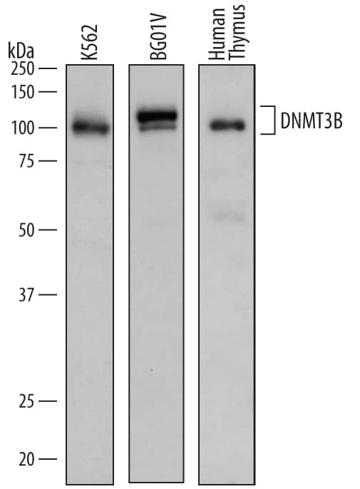 Western blot shows lysates of K562 human chronic myelogenous leukemia cell line, BG01V human embryonic stem cells, and human thymus tissue. PVDF membrane was probed with 0.2 µg/mL of Sheep Anti-Human DNMT3B Antigen Affinity-purified Polyclonal Antibody (Catalog # AF7646) followed by HRP-conjugated Anti-Sheep IgG Secondary Antibody (Catalog # HAF016). Specific bands were detected for DNMT3B at approximately 100-110 kDa (as indicated). This experiment was conducted under reducing conditions and using Immunoblot Buffer Group 1.