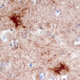 Immunohistochemistry DOCK3 Antibody