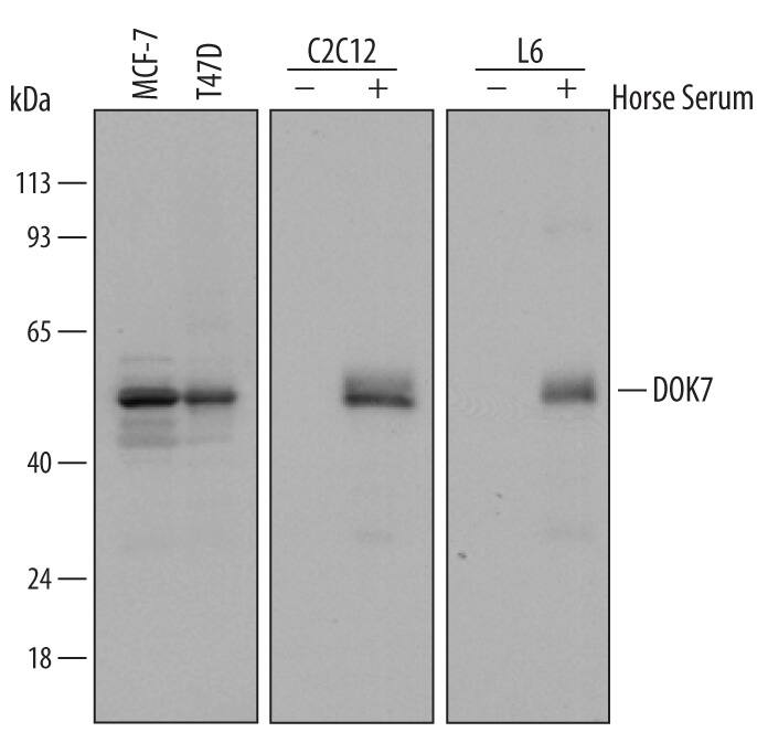 Western blot shows lysates of untreated MCF-7 human breast cancer cell line and T47D human breast cancer cell line and C2C12 mouse myoblast cell line and L6 rat myoblast cell line untreated (-) or treated (+) with 2% horse serum for 6 days. PVDF Membrane was probed with 0.5 µg/mL of Goat Anti-Human/Mouse/Rat DOK7 Antigen Affinity-purified Polyclonal Antibody (Catalog # AF6398) followed by HRP-conjugated Anti-Goat IgG Secondary Antibody (Catalog # HAF109). A specific band was detected for DOK7 at approximately 55 kDa (as indicated). This experiment was conducted under reducing conditions and using Immunoblot Buffer Group 2.