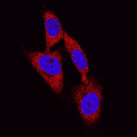 DPP3 was detected in immersion fixed HeLa human cervical epithelial carcinoma cell line using Mouse Anti-Human DPP3 Antigen Affinity-purified Monoclonal Antibody (Catalog # MAB80871) at 8 µg/mL for 3 hours at room temperature. Cells were stained using the NorthernLights™ 557-conjugated Anti-Mouse IgG Secondary Antibody (red; Catalog # NL007) and counterstained with DAPI (blue). Specific staining was localized to cytoplasm. View our protocol for Fluorescent ICC Staining of Cells on Coverslips.