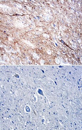 DPP6 was detected in immersion fixed paraffin-embedded sections of human spinal cord using Goat Anti-Human DPP6 Antigen Affinity-purified Polyclonal Antibody (Catalog # AF2360) at 5 µg/mL overnight at 4 °C. Tissue was stained using the Anti-Goat HRP-DAB Cell & Tissue Staining Kit (brown; Catalog # CTS008) and counterstained with hematoxylin (blue). Lower panel shows a lack of labeling when primary antibodies are omitted and tissue is stained only with secondary antibody followed by incubation with detection reagents. View our protocol for Chromogenic IHC Staining of Paraffin-embedded Tissue Sections.