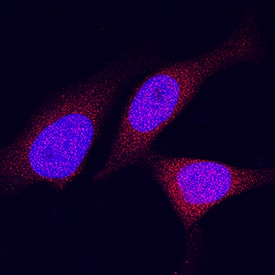 DPP9 was detected in immersion fixed HeLa human cervical epithelial carcinoma cell line using Mouse Anti-Human DPP9 Monoclonal Antibody (Catalog # MAB54191) at 8 µg/mL for 3 hours at room temperature. Cells were stained using the NorthernLights™ 557-conjugated Anti-Mouse IgG Secondary Antibody (red; Catalog # NL007) and counterstained with DAPI (blue). Specific staining was localized to cytoplasm and nuclei. View our protocol for Fluorescent ICC Staining of Cells on Coverslips.