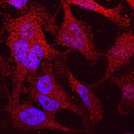 DPP9 was detected in immersion fixed HeLa human cervical epithelial carcinoma cell line using Mouse Anti-Human DPP9 Monoclonal Antibody (Catalog # MAB5419) at 10 µg/mL for 3 hours at room temperature. Cells were stained using the NorthernLights™ 557-conjugated Anti-Mouse IgG Secondary Antibody (red; Catalog # NL007) and counterstained with DAPI (blue). Specific staining was localized to cytoplasm. View our protocol for Fluorescent ICC Staining of Cells on Coverslips.
