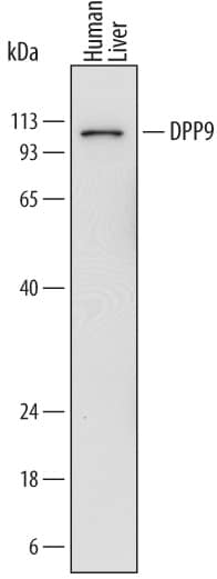 Western blot shows lysates of human liver tissue. PVDF membrane was probed with 1 µg/mL of Mouse Anti-Human DPP9 Monoclonal Antibody (Catalog # MAB5419) followed by HRP-conjugated Anti-Mouse IgG Secondary Antibody (Catalog # HAF018). A specific band was detected for DPP9 at approximately 100 kDa (as indicated). This experiment was conducted under reducing conditions and using Immunoblot Buffer Group 1.