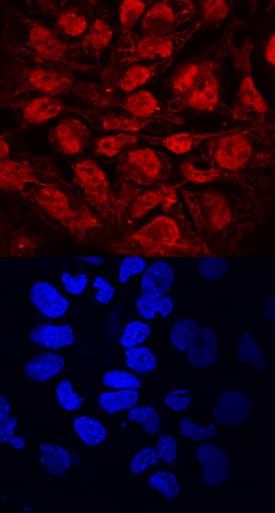 Immunocytochemistry DPPA2 Antibody