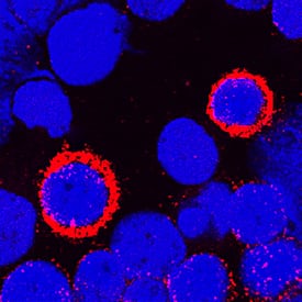 DPPIV/CD26 was detected in immersion fixed human peripheral blood mononuclear cells (PBMCs) using Goat Anti-Human DPPIV/CD26 Antigen Affinity-purified Polyclonal Antibody (Catalog # AF1180) at 1.7 µg/mL for 3 hours at room temperature. Cells were stained using the NorthernLights™ 557-conjugated Anti-Goat IgG Secondary Antibody (red; NL001) and counterstained with DAPI (blue). Specific staining was localized to cytoplasm and plasma membranes. View our protocol for Fluorescent ICC Staining of Non-adherent Cells.