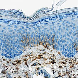 DPPIV/CD26 was detected in immersion fixed paraffin-embedded sections of human psoriatic skin using Goat Anti-Human DPPIV/CD26 Antigen Affinity-purified Polyclonal Antibody (Catalog # AF1180) at 1 µg/mL overnight at 4 °C. Tissue was stained using the Anti-Goat HRP-DAB Cell & Tissue Staining Kit (brown; CTS008) and counterstained with hematoxylin (blue). Specific staining was localized to keratinocytes. View our protocol for Chromogenic IHC Staining of Paraffin-embedded Tissue Sections.