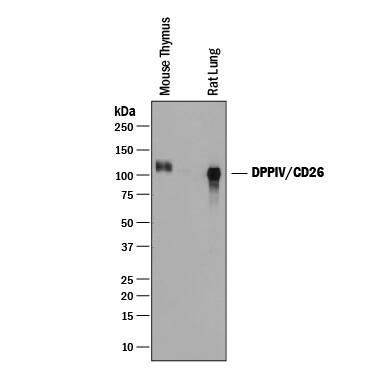 Western blot shows lysates of mouse thymus tissue and rat lung tissue. PVDF membrane was probed with 0.25 µg/mL of Goat Anti-Mouse DPPIV/CD26 Antigen Affinity-purified Polyclonal Antibody (Catalog # AF954) followed by HRP-conjugated Anti-Goat IgG Secondary Antibody (Catalog # HAF019). A specific band was detected for DPPIV/CD26 at approximately 100-110 kDa (as indicated). This experiment was conducted under reducing conditions and using Immunoblot Buffer Group 1.