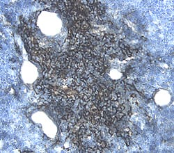 DR3/TNFRSF25 was detected in perfusion fixed frozen sections of mouse thymus using 5 &micro;g/mL Goat Anti-Mouse DR3/TNFRSF25 Antigen Affinity-purified Polyclonal Antibody (Catalog # AF2437) overnight at 4 &deg;C. Tissue was stained with the Anti-Goat HRP-DAB Cell & Tissue Staining Kit (brown; Catalog # CTS008) and counterstained with hematoxylin (blue). View our protocol for Chromogenic IHC Staining of Frozen Tissue Sections.