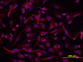 Immunocytochemistry DSCAM Antibody [Unconjugated] - Long Isoform