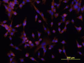 DSCAM was detected in immersion fixed A172 human glioblastoma cell line using Mouse Anti-Human DSCAM Long Isoform Monoclonal Antibody (Catalog # MAB36661) at 10 µg/mL for 3 hours at room temperature. Cells were stained using the NorthernLights™ 557-conjugated Anti-Mouse IgG Secondary Antibody (orange; Catalog # NL007) and counter-stained with DAPI (blue). View our protocol for Fluorescent ICC Staining of Cells on Coverslips.