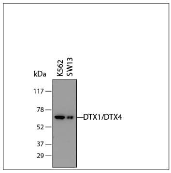 Western Blot DTX1/DTX4 Antibody (730612) [Unconjugated]