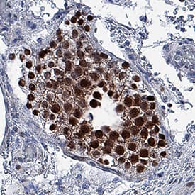 <b>Biological Strategies Validation. </b>DUX4 was detected in immersion fixed paraffin-embedded sections of human testis using Rabbit Anti-Human DUX4 Monoclonal Antibody (Catalog # MAB9535) at 3 µg/mL for 1 hour at room temperature followed by incubation with the Anti-Rabbit IgG VisUCyte™ HRP Polymer Antibody (Catalog # VC003). Tissue was stained using DAB (brown) and counterstained with hematoxylin (blue). Specific staining was localized to nuclei. View our protocol for IHC Staining with VisUCyte HRP Polymer Detection Reagents.