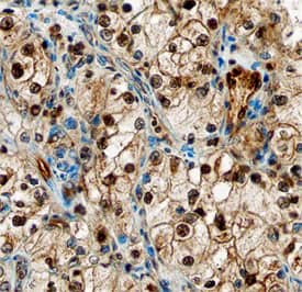 DYRK1A was detected in immersion fixed paraffin-embedded sections of human kidney using Sheep Anti-Human/Rat DYRK1A Antigen Affinity-purified Polyclonal Antibody (Catalog # AF5407) at 10 µg/mL overnight at 4 °C. Before incubation with the primary antibody, tissue was subjected to heat-induced epitope retrieval using Antigen Retrieval Reagent-Basic (Catalog # CTS013). Tissue was stained using the Anti-Sheep HRP-DAB Cell & Tissue Staining Kit (brown; Catalog # CTS019) and counterstained with hematoxylin (blue). Specific staining was localized to nuclei of epithelial cells in convoluted tubules. View our protocol for Chromogenic IHC Staining of Paraffin-embedded Tissue Sections. This application has not been tested in rat samples.