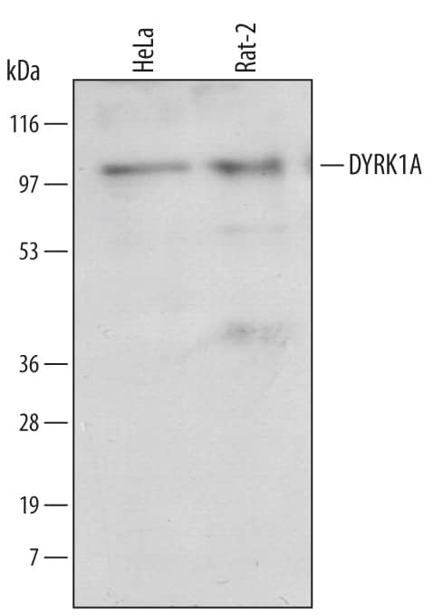 Western blot shows lysates of HeLa human cervical epithelial carcinoma cell line and Rat-2 rat embryonic fibroblast cell line. PVDF membrane was probed with 1 µg/mL of Sheep Anti-Human/Rat DYRK1A Antigen Affinity-purified Polyclonal Antibody (Catalog # AF5407) followed by HRP-conjugated Anti-Sheep IgG Secondary Antibody (Catalog # HAF016). A specific band was detected for DYRK1A at approximately 100 kDa (as indicated). This experiment was conducted under reducing conditions and using Immunoblot Buffer Group 1.