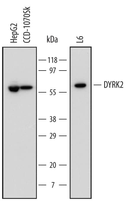 Western Blot DYRK2 Antibody (599542) [Unconjugated]