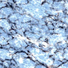 DcTRAIL R1/TNFRSF23 was detected in perfusion fixed frozen sections of mouse thymus using Rat Anti-Mouse DcTRAIL R1/TNFRSF23 Biotinylated Monoclonal Antibody (Catalog # BAM2378) at 25 &micro;g/mL overnight at 4 &deg;C. Tissue was stained using the Anti-Rat HRP-DAB Cell & Tissue Staining Kit (brown; Catalog # CTS017) and counterstained with hematoxylin (blue). Specific labeling was localized to dendritic cells. View our protocol for Chromogenic IHC Staining of Frozen Tissue Sections.