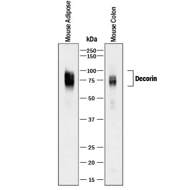 Western Blot Decorin Antibody [Unconjugated]