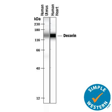 Simple Western lane view shows lysates of human uterus and human heart tissue, loaded at 0.2 mg/mL. A specific band was detected for Decorin at approximately 140-149 kDa (as indicated) using 5 µg/mL of Goat Anti-Human Decorin Antigen Affinity-purified Polyclonal Antibody (Catalog # AF143) . This experiment was conducted under reducing conditions and using the 12-230 kDa separation system.