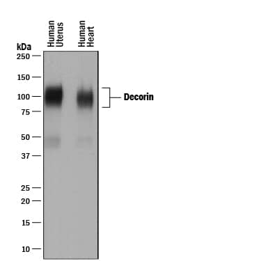 Western blot shows lysates of human uterus tissue and human heart tissue. PVDF membrane was probed with 0.1 µg/mL of Goat Anti-Human Decorin Antigen Affinity-purified Polyclonal Antibody (Catalog # AF143) followed by HRP-conjugated Anti-Goat IgG Secondary Antibody (HAF017). A specific band was detected for Decorin at approximately 100 kDa (as indicated). This experiment was conducted under reducing conditions and using Immunoblot Buffer Group 1.