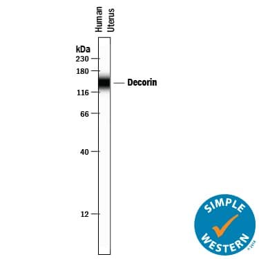 Simple Western lane view shows lysates of human uterus tissue, loaded at 0.2 mg/mL. A specific band was detected for Decorin at approximately 145 kDa (as indicated) using 10 µg/mL of Mouse Anti-Human Decorin Monoclonal Antibody (Catalog # MAB143) . This experiment was conducted under reducing conditions and using the 12-230 kDa separation system.