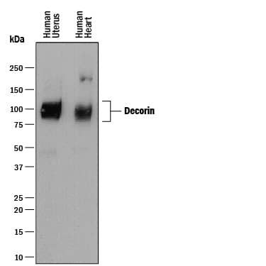 Western blot shows lysates of human uterus tissue and human heart tissue. PVDF membrane was probed with 1 µg/mL of Mouse Anti-Human Decorin Monoclonal Antibody (Catalog # MAB143) followed by HRP-conjugated Anti-Mouse IgG Secondary Antibody (Catalog # HAF018). A specific band was detected for Decorin at approximately 100 kDa (as indicated). This experiment was conducted under reducing conditions and using Immunoblot Buffer Group 1.