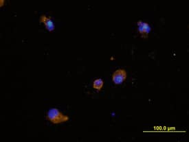 Dectin-1/CLEC7A was detected in immersion fixed mature human dendritic cells using Mouse Anti-Human Dectin-1/CLEC7A Monoclonal Antibody (Catalog # MAB1859) at 10 µg/mL for 3 hours at room temperature. Cells were stained using the NorthernLights™ 557-conjugated Anti-Mouse IgG Secondary Antibody (yellow; Catalog # NL007) and counterstained with DAPI (blue). View our protocol for Fluorescent ICC Staining of Non-adherent Cells.