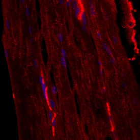Immunohistochemistry Desmin Antibody [Unconjugated]