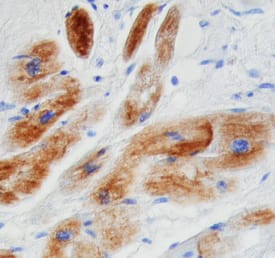 Immunohistochemistry Desmin Antibody [Unconjugated]