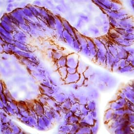 Immunohistochemistry Desmocollin-2 Antibody