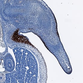 Desmocollin-3 was detected in immersion fixed frozen sections of mouse embryo (13 d.p.c.) using Sheep Anti-Mouse Desmocollin-3 Antigen Affinity-purified Polyclonal Antibody (Catalog # AF7265) at 1.7 µg/mL overnight at 4 °C. Tissue was stained using the Anti-Sheep HRP-DAB Cell & Tissue Staining Kit (brown; Catalog # CTS019) and counterstained with hematoxylin (blue). Specific staining was localized to the epidermis of the developing limb bud. View our protocol for Chromogenic IHC Staining of Frozen Tissue Sections.