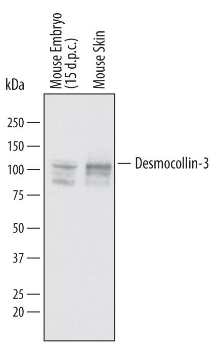 Western blot shows lysates of mouse embryo (15 d.p.c.) tissue and mouse skin tissue. PVDF membrane was probed with 1 µg/mL of Sheep Anti-Mouse Desmocollin-3 Antigen Affinity-purified Polyclonal Antibody (Catalog # AF7265) followed by HRP-conjugated Anti-Sheep IgG Secondary Antibody (Catalog # HAF016). Specific bands were detected for Desmocollin-3 at approximately 90-110 kDa (as indicated). This experiment was conducted under reducing conditions and using Immunoblot Buffer Group 1.