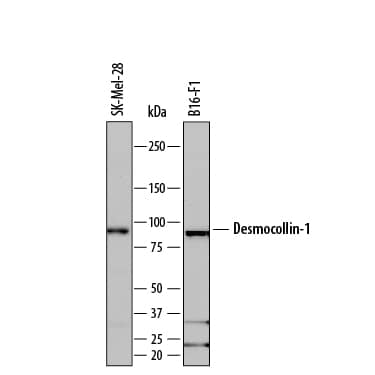 Western blot shows lysates of SK-Mel-28 human malignant melanoma cell line and B16-F1 mouse melanoma cell line. PVDF membrane was probed with 0.1 µg/mL of Rat Anti-Human/Mouse Desmocollin-1 Monoclonal Antibody (Catalog # MAB7367) followed by HRP-conjugated Anti-Rat IgG Secondary Antibody (Catalog # HAF005). A specific band was detected for Desmocollin-1 at approximately 98 kDa (as indicated). This experiment was conducted under reducing conditions and using Immunoblot Buffer Group 1.