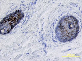Immunohistochemistry Desmoglein-1 Antibody [Unconjugated] - Propeptide