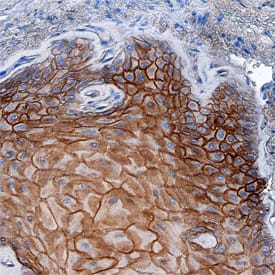 Immunohistochemistry Desmoglein-3 Antibody (216519) [Unconjugated]