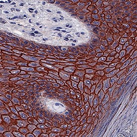 Desmoglein-1 was detected in immersion fixed paraffin-embedded sections of human skin hyperplasia using Mouse Anti-Human Desmoglein-1 Monoclonal Antibody (Catalog # MAB944) at 5 µg/mL for 1 hour at room temperature followed by incubation with the Anti-Mouse IgG VisUCyte™ HRP Polymer Antibody (Catalog # VC001). Tissue was stained using DAB (brown) and counterstained with hematoxylin (blue). Specific staining was localized to keratinocyte membranes. View our protocol for IHC Staining with VisUCyte HRP Polymer Detection Reagents.