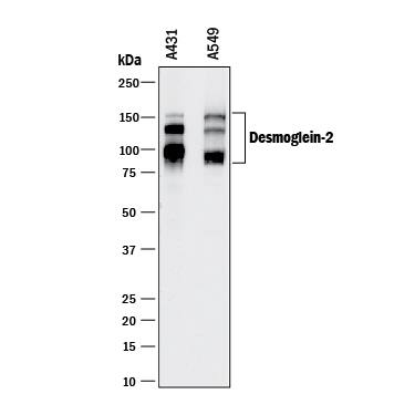 Western blot shows lysates of A431 human epithelial carcinoma cell line and A549 human lung carcinoma cell line. PVDF membrane was probed with 0.25 µg/mL of Goat Anti-Human Desmoglein-2 Antigen Affinity-purified Polyclonal Antibody (Catalog # AF947) followed by HRP-conjugated Anti-Goat IgG Secondary Antibody (Catalog # HAF017). Specific bands were detected for Desmoglein-2 at approximately 90-160 kDa (as indicated). This experiment was conducted under reducing conditions and using Immunoblot Buffer Group 1.