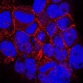<b>Genetic Strategies Validation. </b>Desmoglein-2 was detected in immersion fixed A431 human epithelial carcinoma cell line wildtype and knockout using Mouse Anti-Human Desmoglein-2 Monoclonal Antibody (Catalog # MAB947) at 10 µg/mL for 3 hours at room temperature. Cells were stained using the NorthernLights™ 557-conjugated Anti-Mouse IgG Secondary Antibody (red; Catalog # NL007) and counterstained with DAPI (blue). Specific staining was localized to plasma membrane. View our protocol for Fluorescent ICC Staining of Cells on Coverslips.