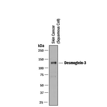 Western Blot Desmoglein-3 Antibody (216519) [Unconjugated]