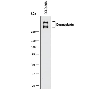 Western Blot Desmoplakin Antibody (824038) [Unconjugated]